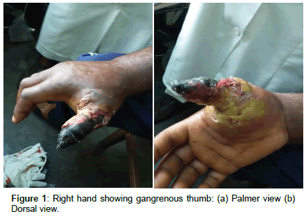 clinical-images-case-reports-Dorsal-view