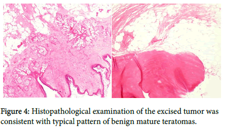 clinical-images-case-reports-Histopathological