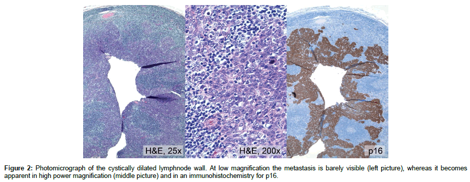 clinical-images-case-reports-Photomicrograph