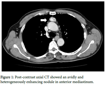 clinical-images-case-reports-Post-contrast