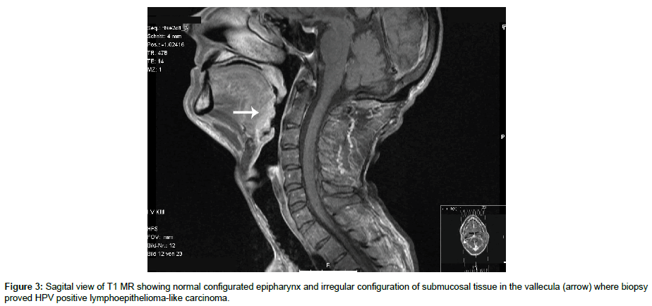 clinical-images-case-reports-Sagital-view