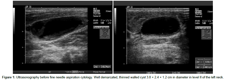 clinical-images-case-reports-Ultrasonography