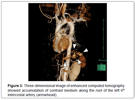 clinical-images-case-reports-arrowhead