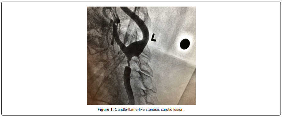 clinical-images-case-reports-carotid-lesion