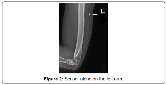 clinical-images-case-reports-left-arm