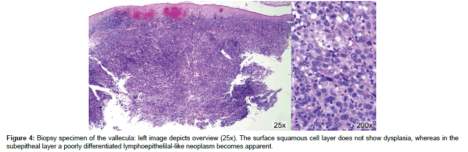 clinical-images-case-reports-left-image