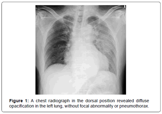 clinical-images-case-reports-left-lung