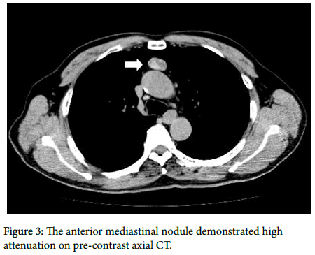 clinical-images-case-reports-mediastinal