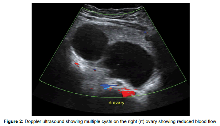 clinical-images-case-reports-multiple-cysts