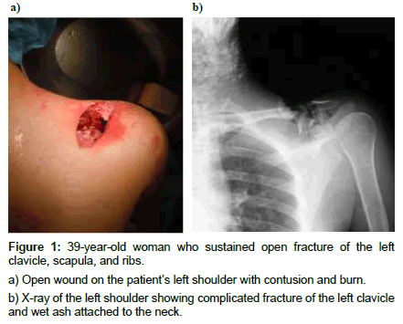 clinical-images-case-reports-open-fracture