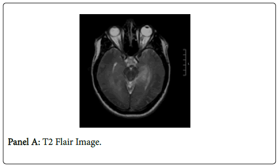 clinical-images-case-reports-panel-a