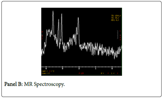 clinical-images-case-reports-panel-b