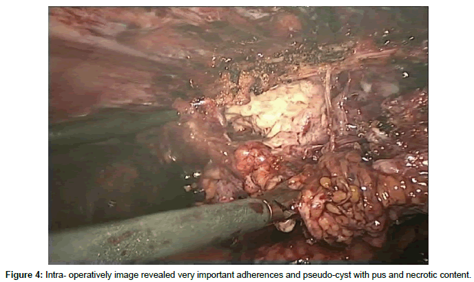 clinical-images-case-reports-pseudo-cyst