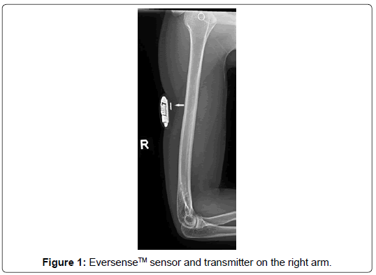 clinical-images-case-reports-right-arm