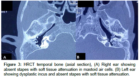 clinical-images-case-reports-soft-tissue