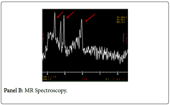 clinical-images-case-reports-spectroscopy