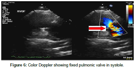 clinical-images-case-reports-systole