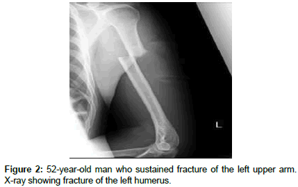 clinical-images-case-reports-upper-arm