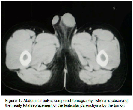 clinical-oncology-Abdominal-pelvic