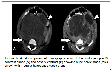 clinical-oncology-Axial-computerized