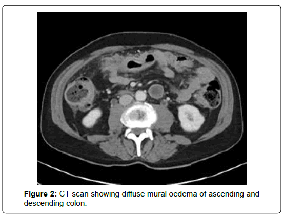 clinical-oncology-CT-scan