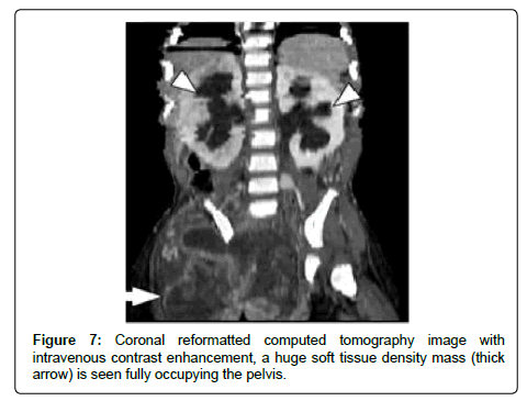 clinical-oncology-Coronal-reformatted