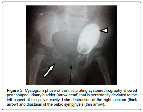 clinical-oncology-Cystogram-phase