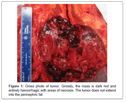 clinical-oncology-Gross-photo