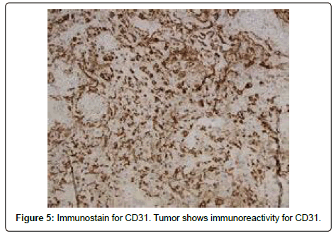 clinical-oncology-Immunostain