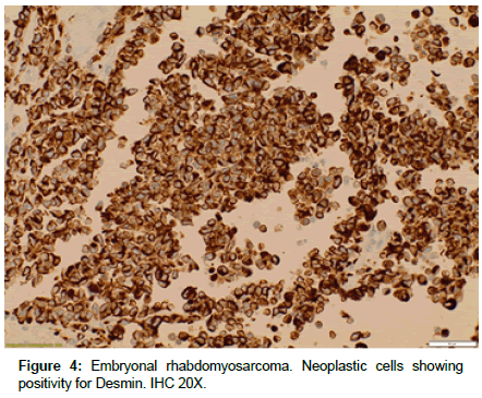 clinical-oncology-Neoplastic-cells