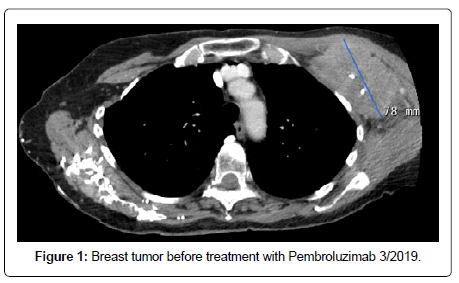 clinical-oncology-Pembroluzimab