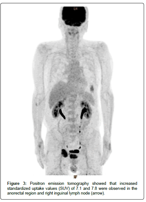 clinical-oncology-Positron-emission