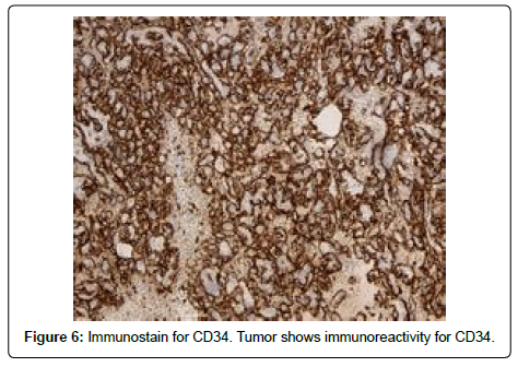 clinical-oncology-Tumor