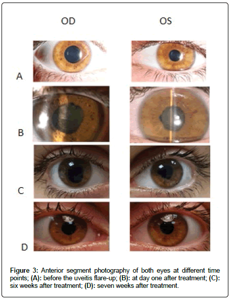clinical-oncology-case-Anterior clinical-oncology-case-Anterior