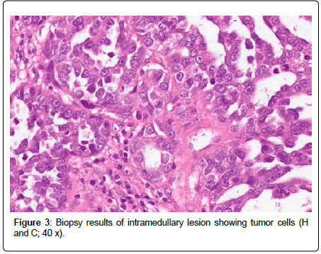 clinical-oncology-case-Biopsy