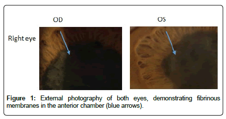 clinical-oncology-case-eyes clinical-oncology-case-eyes