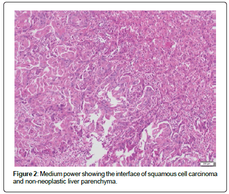 clinical-oncology-case-interface