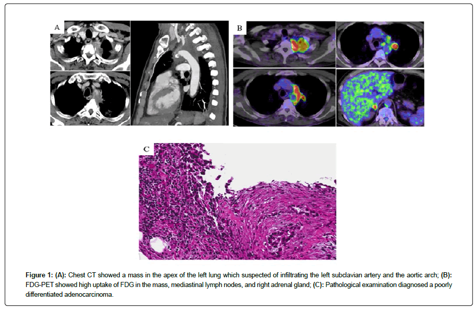 clinical-oncology-case-mass