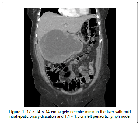 clinical-oncology-case-necrotic