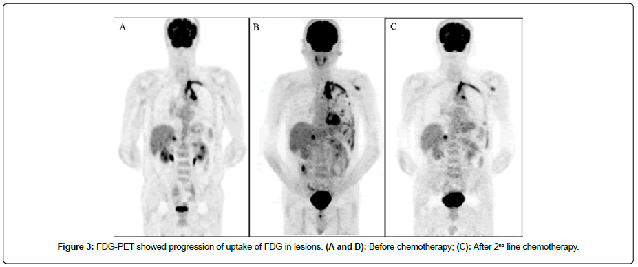 clinical-oncology-case-progression