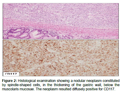 clinical-oncology-case-reports-Histological-examination