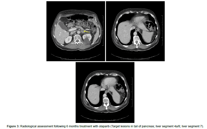 clinical-oncology-case-reports-assessment