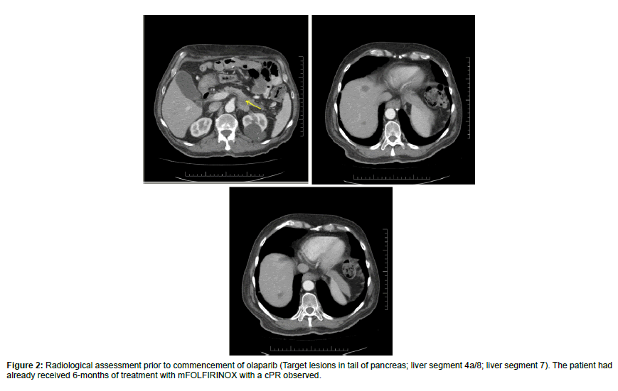clinical-oncology-case-reports-assessment-prior clinical-oncology-case-reports-assessment-prior