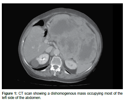 clinical-oncology-case-reports-dishomogenous-mass