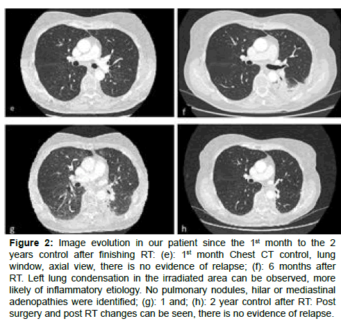 clinical-oncology-case-reports-inflammatory-etiology