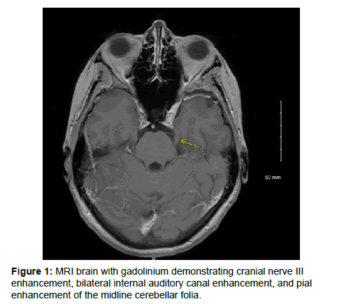 clinical-oncology-case-reports-midline-cerebellar