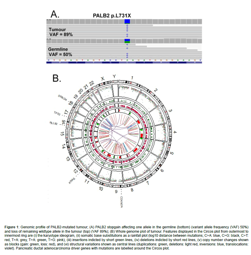 clinical-oncology-case-reports-mutated-tumour