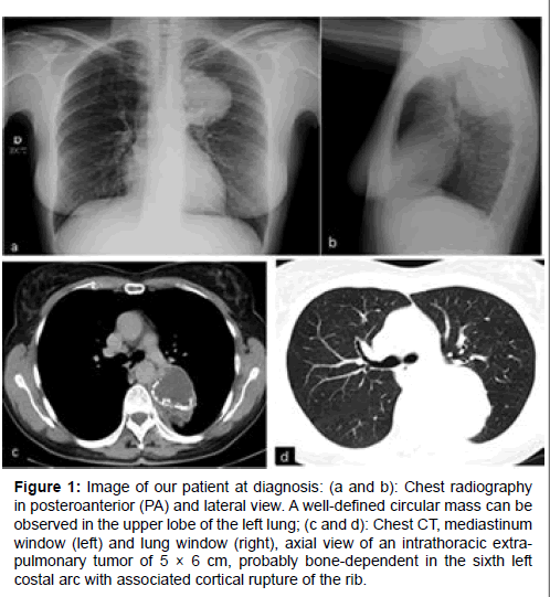 clinical-oncology-case-reports-patient-diagnosis