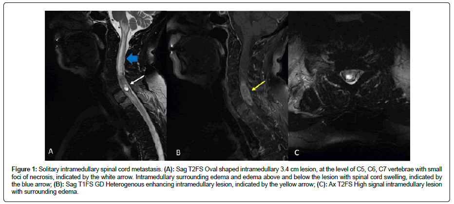 clinical-oncology-case-signal