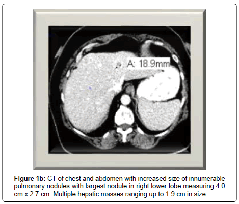 clinical-oncology-chest-abdomen